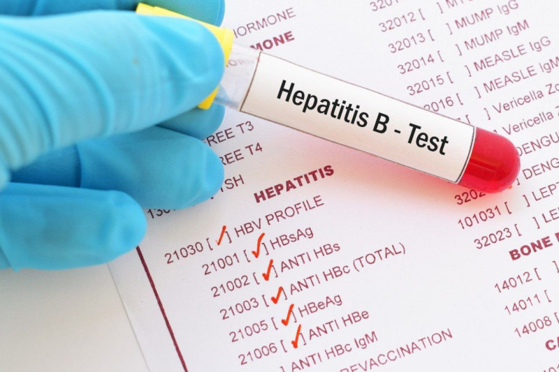 Ini Gejala Dan Penularan Hepatitis B | YesDok